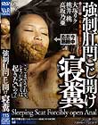 強制肛門こじ開け寝糞