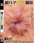 超ドUPアナル観察
